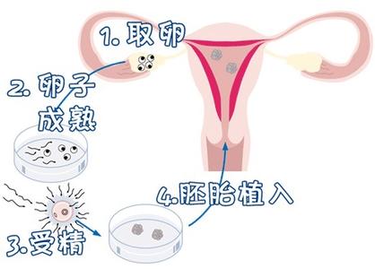 Dr. Zhang